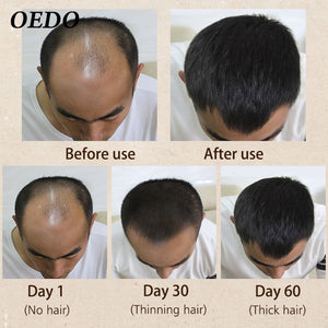 Morocco Herbal Ginseng Keratin Hair Treatment For Men And Women Hair Loss Powerful Hair Care Growth Serum Repair Shampoo Lador