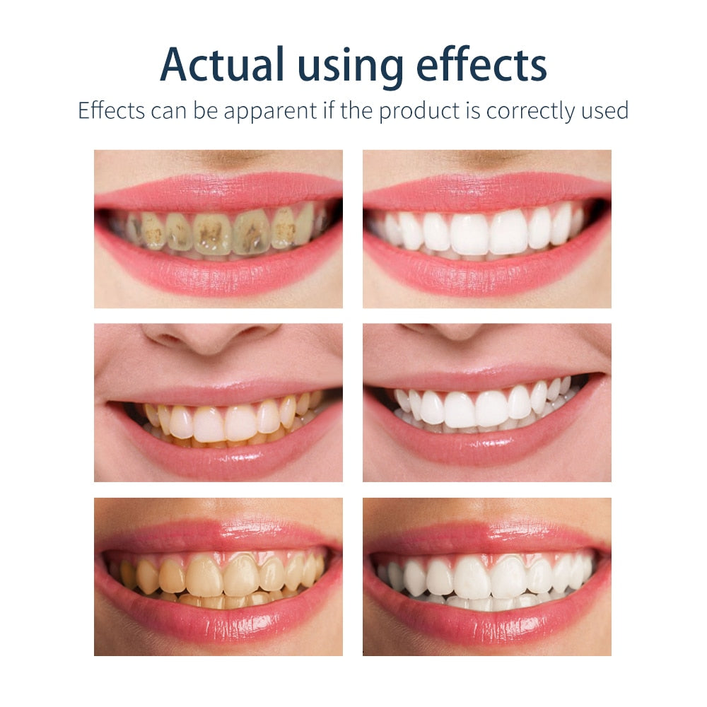 BAIMISS Teeth Whitening Mousse Toothpaste Tooth-Cleaning Fresh Shining Oral Hygiene Removes Plaque Stains Bad Breath Dental Tool