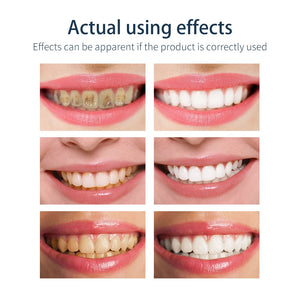 BAIMISS Teeth Whitening Mousse Toothpaste Tooth-Cleaning Fresh Shining Oral Hygiene Removes Plaque Stains Bad Breath Dental Tool