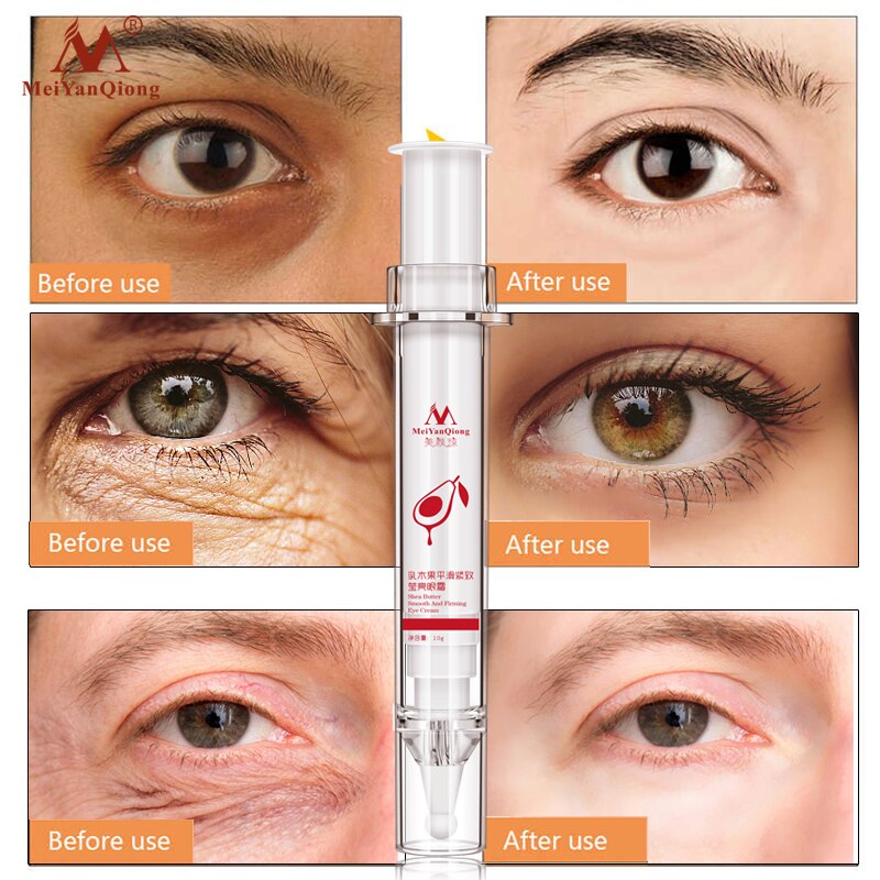 Anti-Puffiness Black Dark Circle Remover Anti-Aging  Eye Cream Advanced Repair Eye Creams Moisturizing Collagen Skin Care
