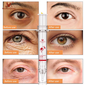 Anti-Puffiness Black Dark Circle Remover Anti-Aging  Eye Cream Advanced Repair Eye Creams Moisturizing Collagen Skin Care
